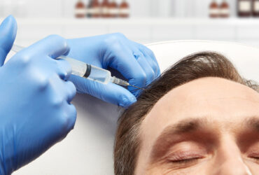 PRP Hair Treatment